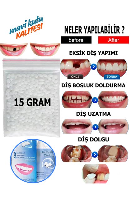 15 Gram Pro Versiyon Thermo Granül Eksik Diş Yapımı Diş Dolgusu ve Diş Boşluk Doldurma Diş Tamiri Granülleri
