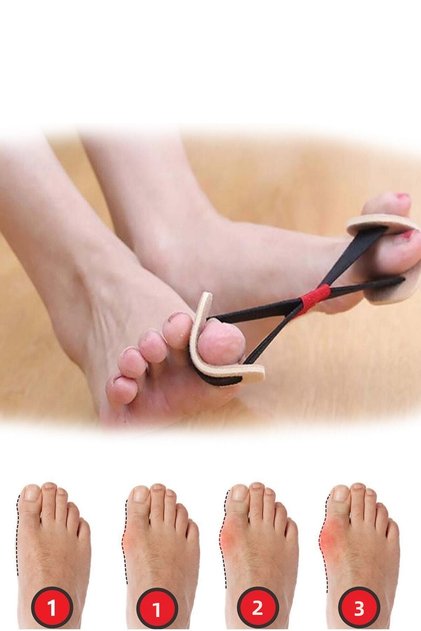 Aveo 2 Pieces Foot Big Toe Bone Corrector Exercise Rubber