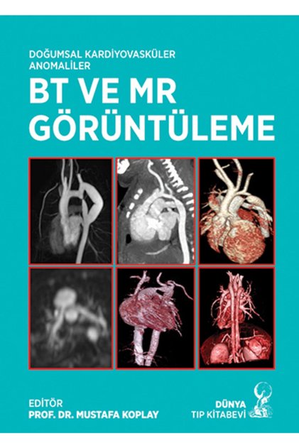 Doğumsal Kardiyovasküler Anomaliler Bt Ve Mr Görüntüleme