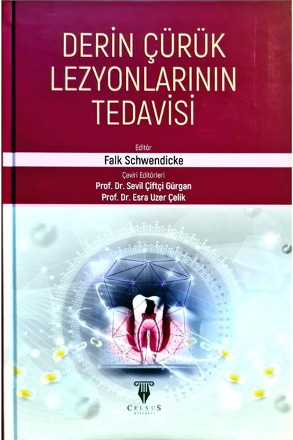 Derin Çürük Lezyonlarının Tedavisi