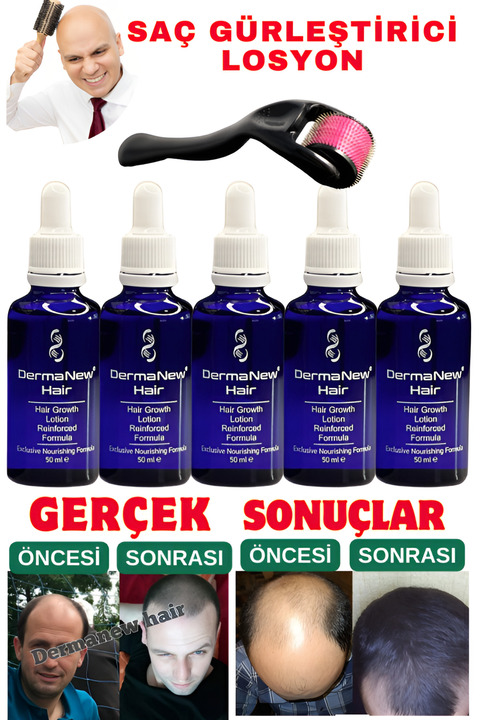 dermanew hair Dermanew Saç Losyonu Saç Bakım Yağı - Saç Gürleştirici - Sac Serumu losyon 5 Adet Roller