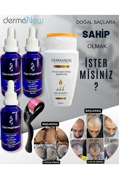 dermanew hair Sac Bakimi Sac Serum Ve Yagi - Sac Bakım Yağı - Saç Cıkartıcı Serum - 3 Adet Serum Roller Şampuan