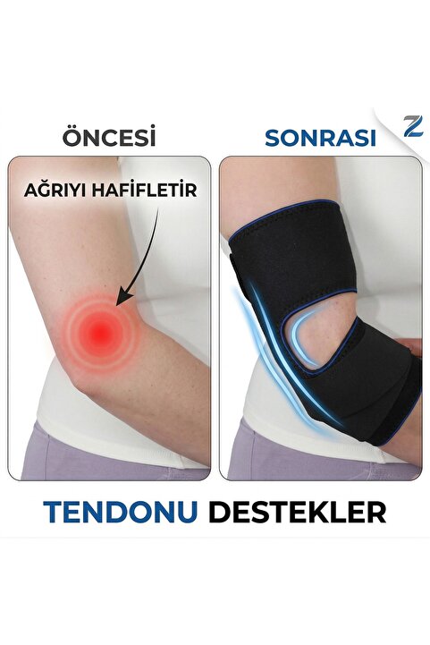 zabinza Epikondilit Bandajı Tenisçi Dirseği Bandı Golfçü Dirseği Destekli Dirseklik Kol Sabitleyici Sporcu Dirsek Koruyucu Ayarlanabilir Sıkılaştırmalı Dirsek Bandı