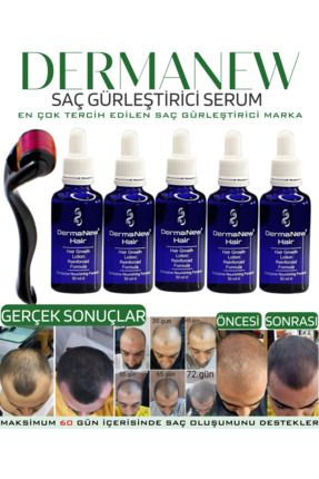 Dermanewhair Saç Gürleştirici Losyon Saç Losyonu - Dermanew - Sac Sıkarıcı / 5 Adet Serum Roller