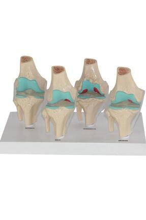 Diz Eklem Anatomi İskelet Ligamentli 28x8 Cm Eklem Modeli Tıp Bilimi Öğretim Malzemeleri