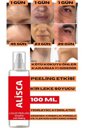 Soyucu Peeling Jel Krem Arındırıcı Sıkılaştırıcı Aydınlatıcı Yenileyici Siyah Nokta Yüz Temizleme