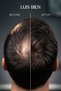 Anti-Hair Loss Blue Serum – Hair Root Care Serum, Intensive Strengthening Formula - 4