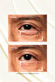 Lacto-Pdrn* 4% + B9 - Eye Cream with Lifting Effect and Anti-Wrinkle Appearance - 7