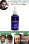 Hair Lotion - Hair Strengthening - Hair Care - Hair Lotion / 3 Rollers - 8