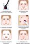 ديرما رولر من التيتانيوم الأسود - 540 إبرة، 0.5 مم - 2
