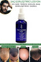 Dermanew Sac Serum - Hair Care Hair Lotion / 3 Serum Rollers - 3