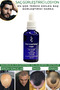 Dermanew Sac Serum - Hair Care Hair Lotion / 3 Serum Rollers - 5