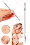 Comedone 2-Piece Steel Set to Help Remove Blackheads, Acne and Acne Blemishes - 2