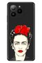 X7 Compatible Case Patterned Printed Silicone Xfridax