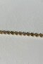 Spring Fields Bracelet - Comfortable and Stylish Design - 3
