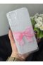 Xiaomi Redmi Note 11S - Note 11 Compatible Printed Transparent Phone Case