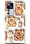 Xiaomi Mi 12t Pro Case Hd Printed Case - Followed Institution 5047