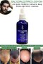Dermanew Hair Lotion Hair Care Oil - Hair Strengthening - Hair Serum Lotion 5 Rollers - 4