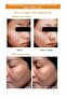 Sebum Balancing Mattifying, Anti-Acne, Brightening Gel 30 ml - 3