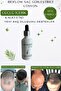 Bioflow Hair Hair Strengthening Lotion / Solution for Hair Loss from the Root / 3 Dermarollers - 3