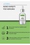 Anti-Acne Face Serum & Anti-Acne Face Perfecting Serum 15ml - 2