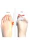 New Thumb - Separating and Relaxing Silicone Gel - 5