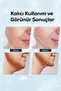 Face and Neck Skin Care Device – with Ems Led Technology and Firming - 6