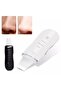 Ultrasonic Blackhead Acne Scrubber Spatula Rechargeable Skin Cleaner - 8