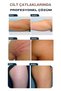Stretch Mark Cream Set - Set of 4 - Premium Care Against Stretch Marks - Home and Professional Use - 9