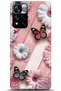 Xiaomi Redmi Note 11 Pro Plus 5g Case Hd Printed Case - Followed Institution 0641
