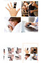 Five Finger Compatible Mollet Finger Splint - Broken Post - 2