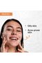 2% Salicylic Acid Salyzap Facial Cleanser|Sutable for Oily,Acne Prone & Sensitive Skin 60gm - 4