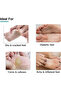 Foobetik Foot Cream for Diabetic, Dry & Cracked Feet 50g - 3