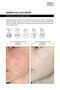 Koreaco Anti-Blackheads Acne Ampoule Blackhead and Acne Ampoule - 4