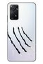 Xiaomi Redmi Note 11 Pro 5g Compatible Case 0.4mm Laser Cut Silicone Claw