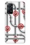 Xiaomi Redmi Note 11 Pro 5g Compatible Case 0.4mm Laser Cut Silicone Pipes