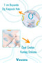 Baby Reflux Bed, Zippered, Washable Cover, Special Production, 100% Cotton Fabric - 4