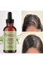 Rosemary Rosemary Hair Strengthening Hair Serum Anti-Hair Loss Effective Hair Care Oil + Derma Roller - 6