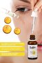 Vitamin C Serum 30 ml Brightening, Anti-Blemish and Skin Tone Equalizer - 7