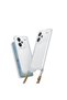 Redmi Note 13 Pro Plus 5g Compatible Case with Attachable Strap and Snap Silicone Cover - Transparent - T34795 - 2