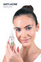 Si Vilce and Anti-Blackhead Azelaic Acid Serum - Anti-Acne Serum - 30 ml - 3