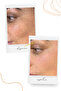 Brightening, Anti-Blemish and Skin Tone Equalizing 20% Ascorbic Acid Vitamin C Care Serum 30 ml - 3