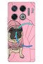 Infinix Gt 20 Pro Case Infinix Patterned Silicone Printed Ornate Style Pug