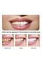 Lanbena Boron Tooth Calculus Removal Serum - Tooth Calculus Cleaner - 3