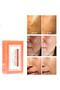 Turmeric and Kojic Acid Effective Anti-Blemish Kojic Acid Soap - 2