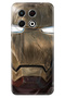Spark 30 Pro Case Cover Patterned Kl7 6.78" Flexible Cover Ironmanmix