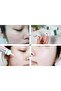 AHA BHA PHA 14 Days Super Miracle Spot All Kill Cream 30ml - 9