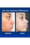 Foaming Acne Wash Maximum Strength 5.5 oz (Pack of 1) - 5