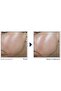 Derm Correxion Contour Cream 50 ml - 9