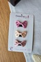 3-Piece Ribbon and Bow Hairless Baby Buckle - Baby Girl Buckle Set with Less Hair Newborn Buckle with Snap Fasteners